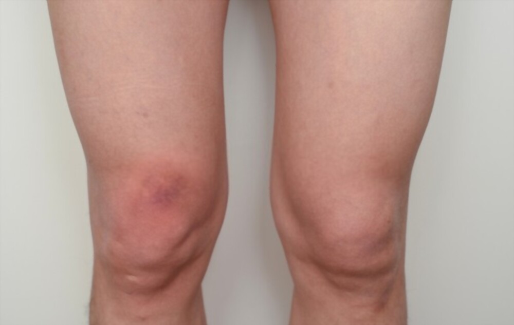 Top 10 most painful injuries 6 GetPaidStock.com 61d3dce04b865